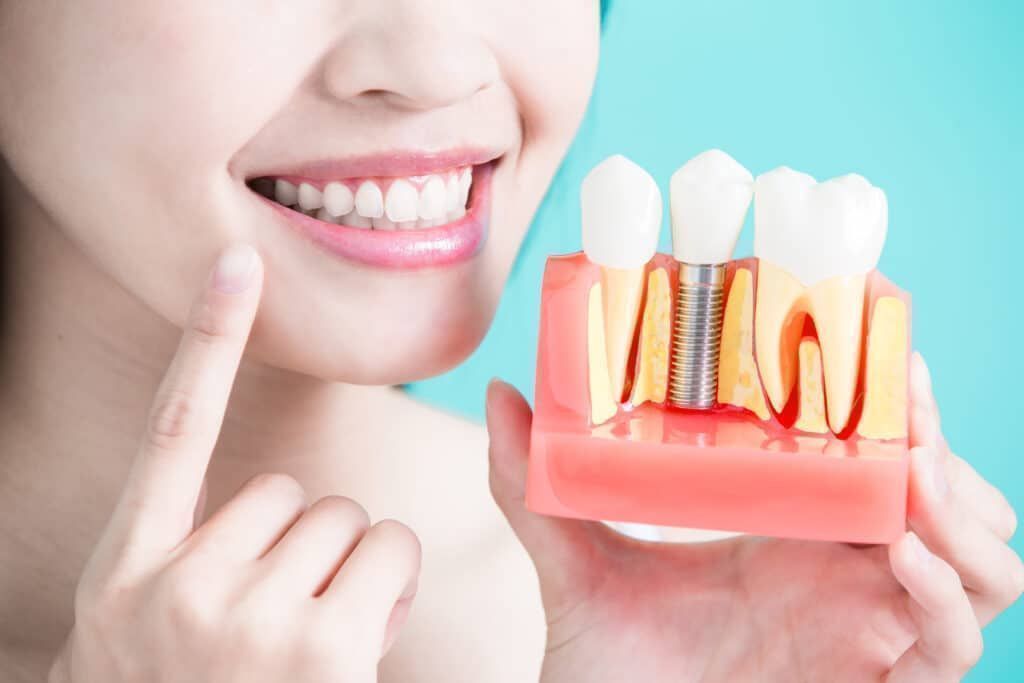 Is it painful to get a dental implant?